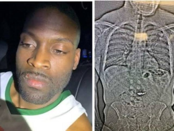 US man who swallowed $760,000 Tiffany jewellery awaits sentencing