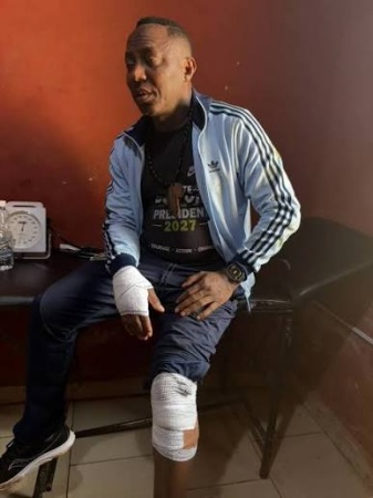Sowore, police clash over account of attack in Ekiti