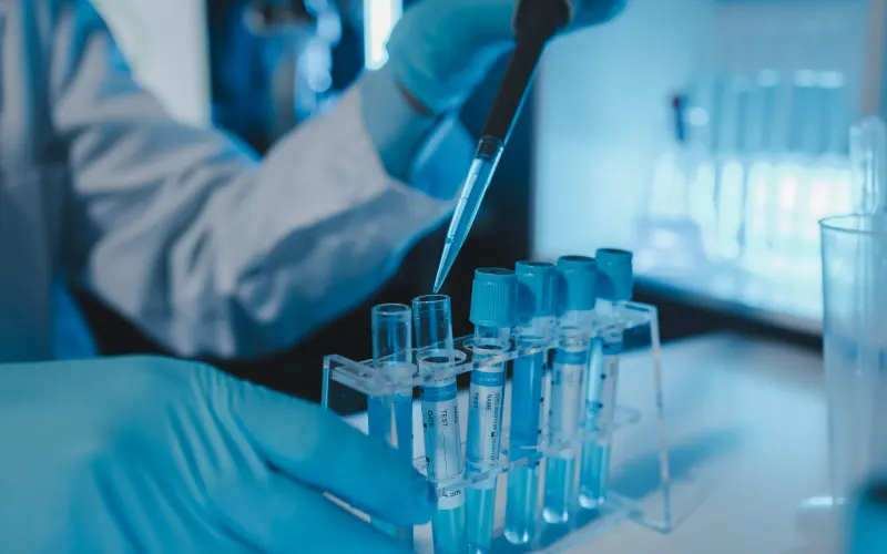 Researcher at Russian plague laboratory dies of ‘unknown’ infection