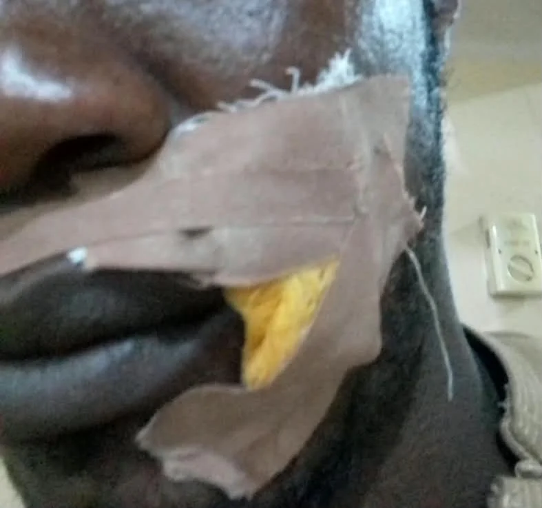 ADC supporter injured in Edo gun attack